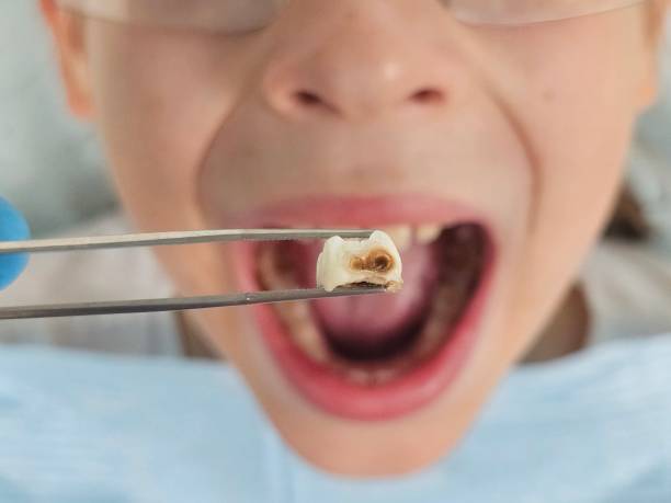 Best Broken Tooth Emergency  in Emma, NC