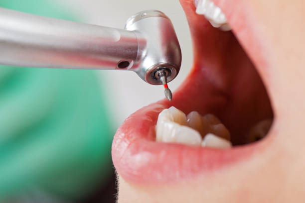 Best Dentist Open Late Near Me  in Emma, NC